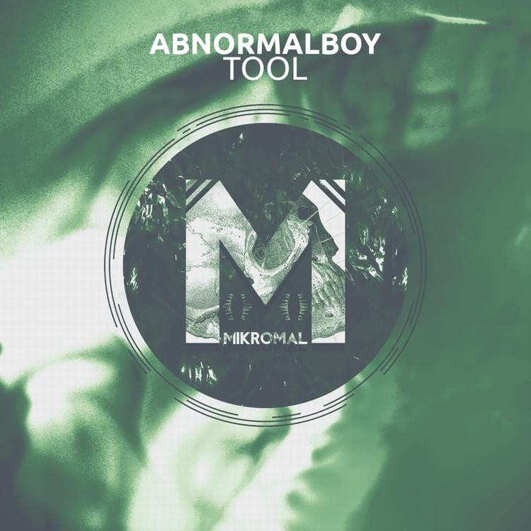 AbnormalBoy's avatar image