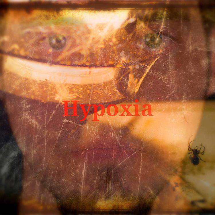 Hypoxia's avatar image