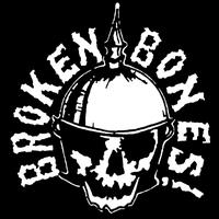 Broken Bones's avatar cover