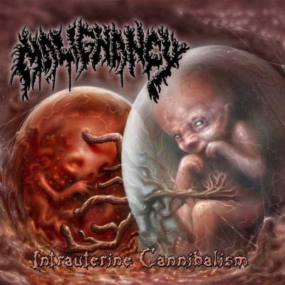 Cerebral Tissue Extraction By Malignancy's cover