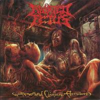 Aborted Fetus's avatar cover