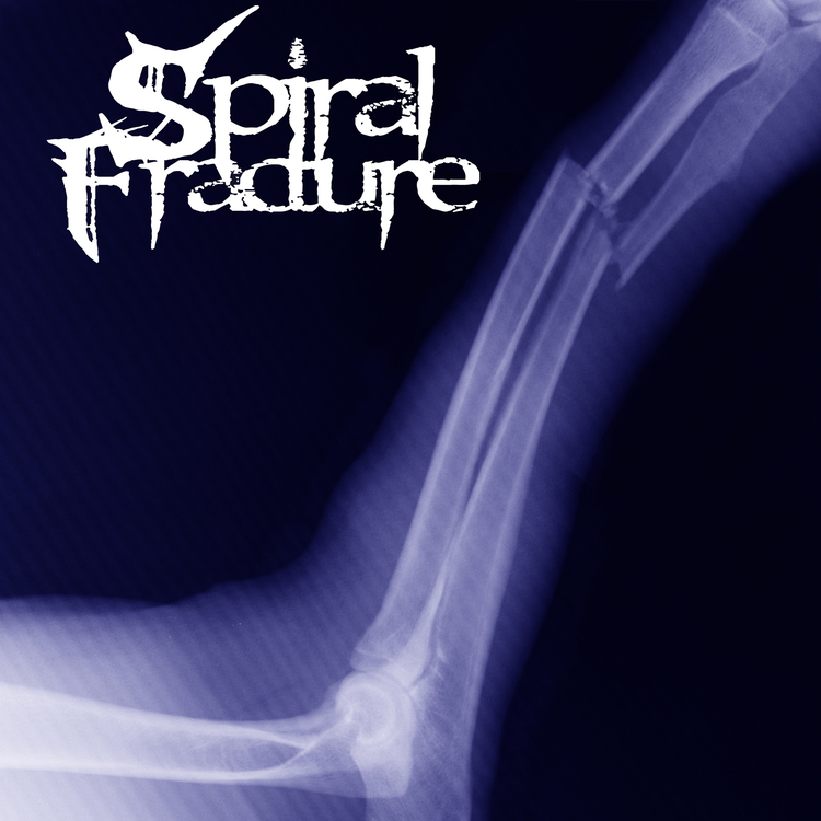 Spiral Fracture's avatar image