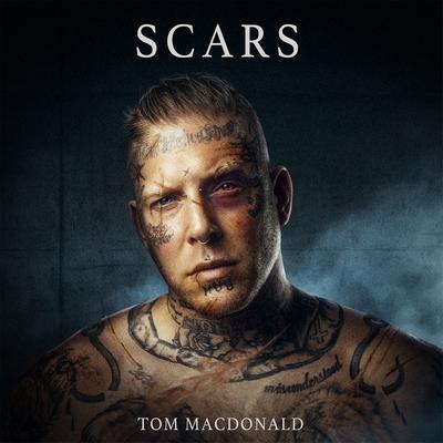 Scars By Tom MacDonald's cover