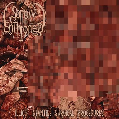 Illicit Infantile Surgical Procedures (Single) By Sorrow Enthroned's cover