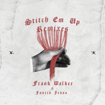 Stitch Em Up - The Remixes's cover