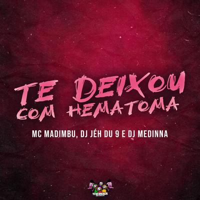 Te Deixou Com Hematoma By Mc Madimbu, DJ Jéh Du 9, Dj Medinna's cover