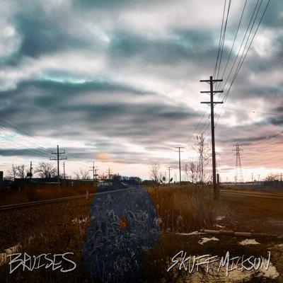 Bruises By Skuff Micksun's cover