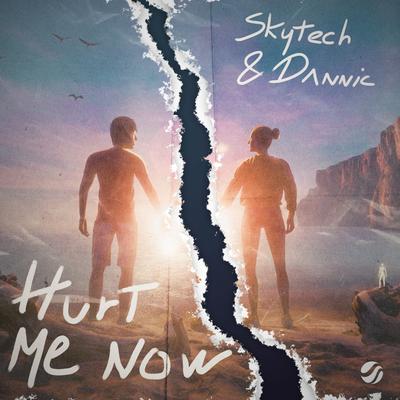 Hurt Me Now By Skytech, Dannic's cover