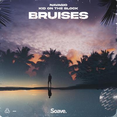Bruises By Navagio, Kid On The Block's cover