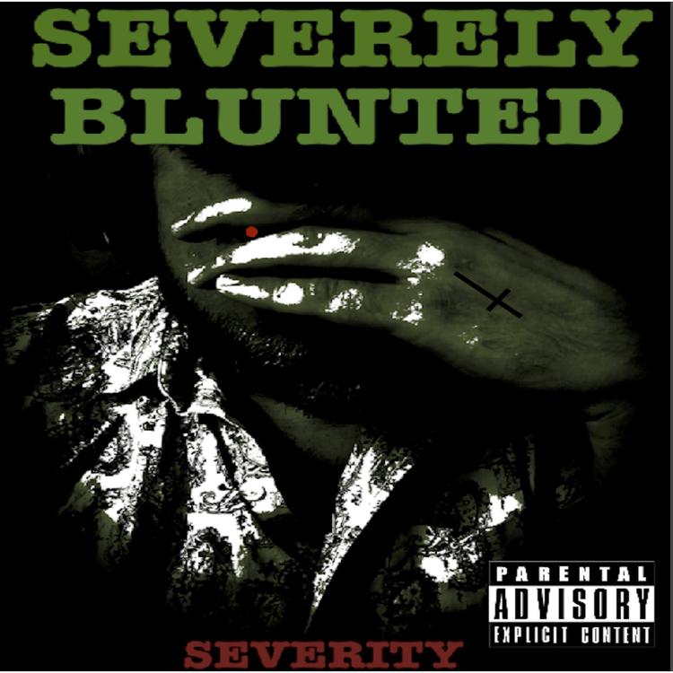 Severity's avatar image