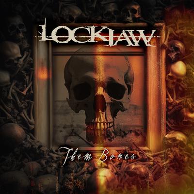 Them Bones (Cover) By Lockjaw's cover