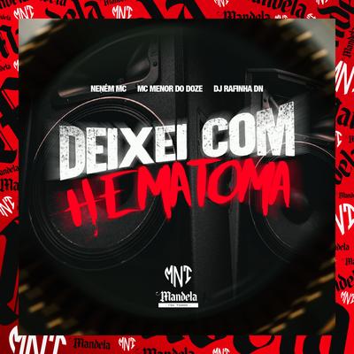 Deixei Com Hematoma's cover