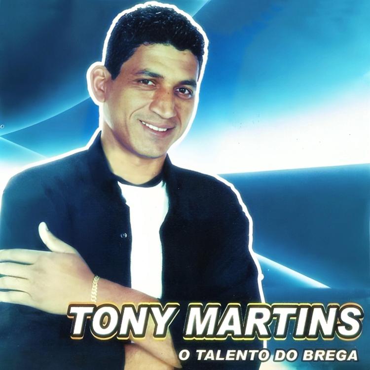 Tony Martins's avatar image