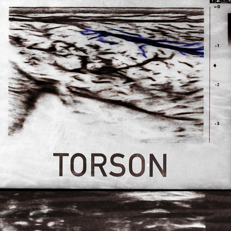 Torson's avatar image