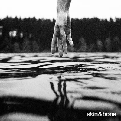 skin & bone By Who Is Jack's cover