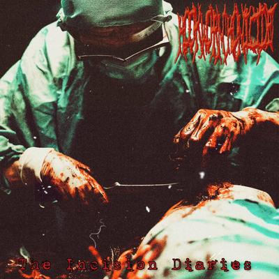 Human Evisceration's cover